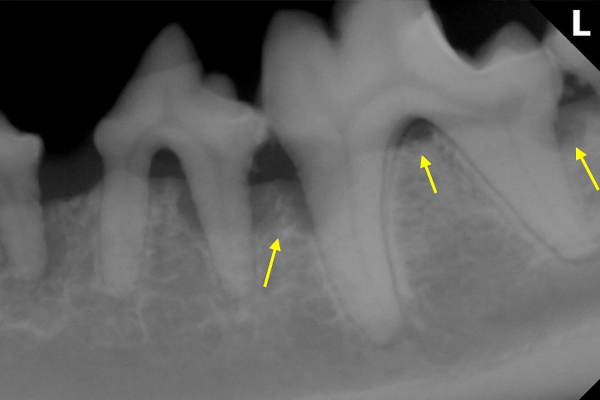 レントゲンと正確な歯科記録
